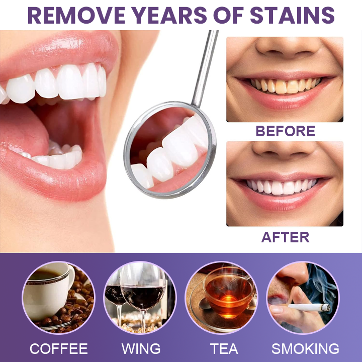Last Day Discount ⏳LIMETOW™ Instant Teeth Whitening Paint: Smile Confidently🌟
