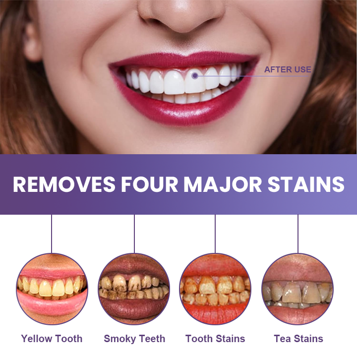 Last Day Discount ⏳LIMETOW™ Instant Teeth Whitening Paint: Smile Confidently🌟