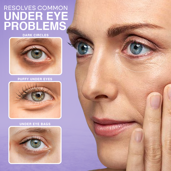 ⏰Limited Time Offer⏰LIMETOW™ Under Eye Puffiness Remover