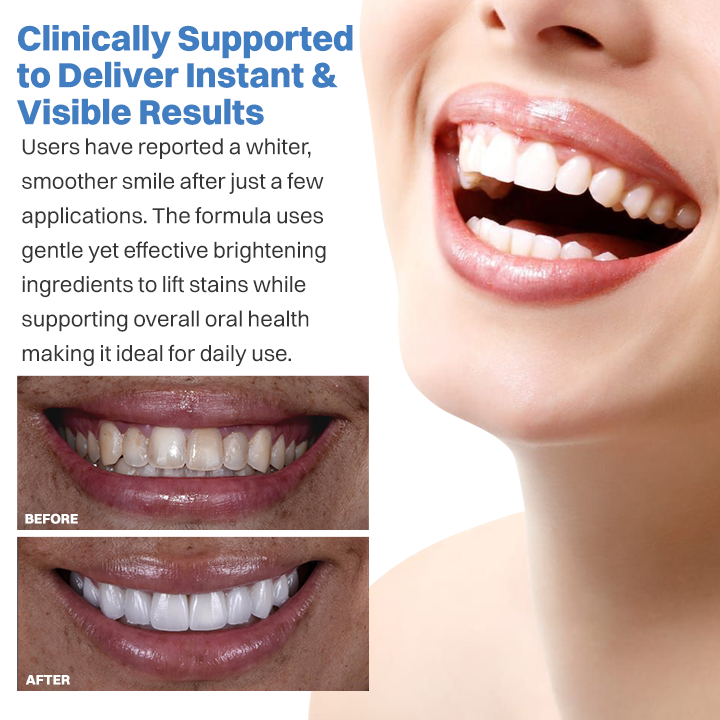 LIMETOW® Teeth Whitening Essence