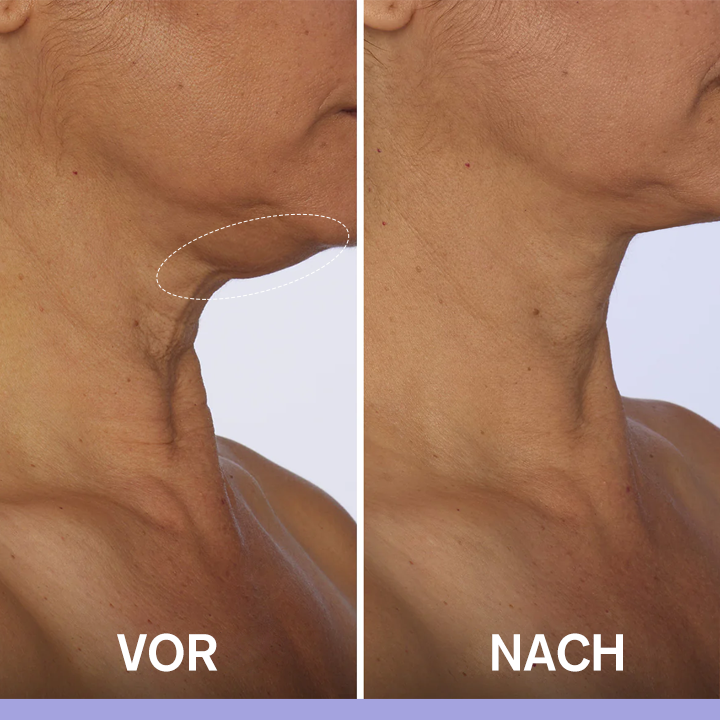 LIMETOW® Tighten & Lift Neck Cream 🔥New Product Discounts🔥 Last Day✨