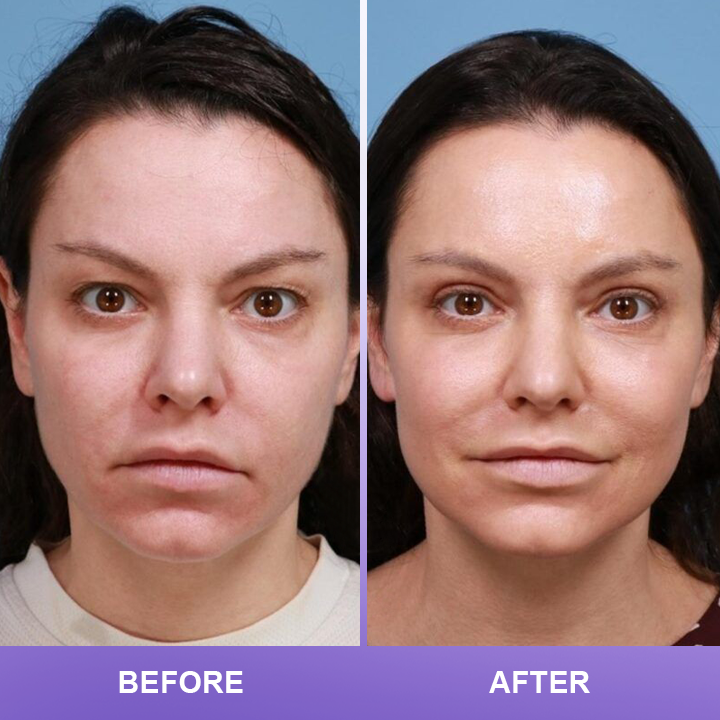 ⏰Limited Time Offer⏰LIMETOW™ Double Eyelid Cream