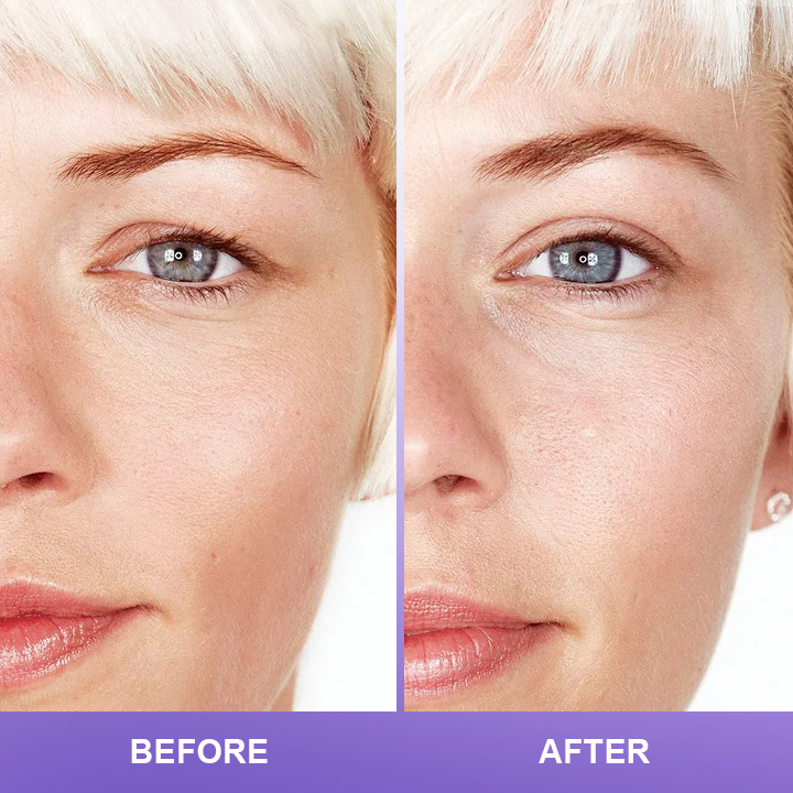 ⏰Limited Time Offer⏰LIMETOW™ Double Eyelid Cream