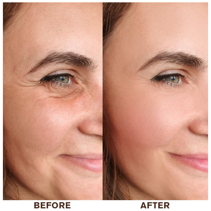 👨⚕️💐Made and Shipped from USA✨LIMETOW™ Instant Eye Cream Tightener😎LAST DAY 50%OFF