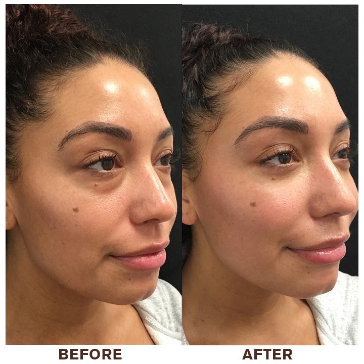 👨⚕️💐Made and Shipped from USA✨LIMETOW™ Instant Eye Cream Tightener😎LAST DAY 50%OFF