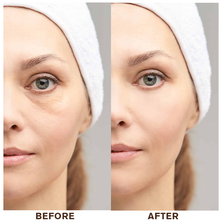 👨⚕️💐Made and Shipped from USA✨LIMETOW™ Instant Eye Cream Tightener😎LAST DAY 50%OFF
