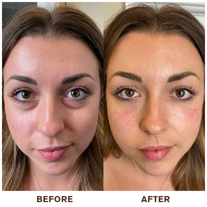 👨⚕️💐Made and Shipped from USA✨LIMETOW™ Instant Eye Cream Tightener😎LAST DAY 50%OFF