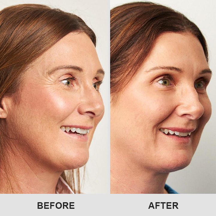 LIMETOW® Retinol Eye Stick