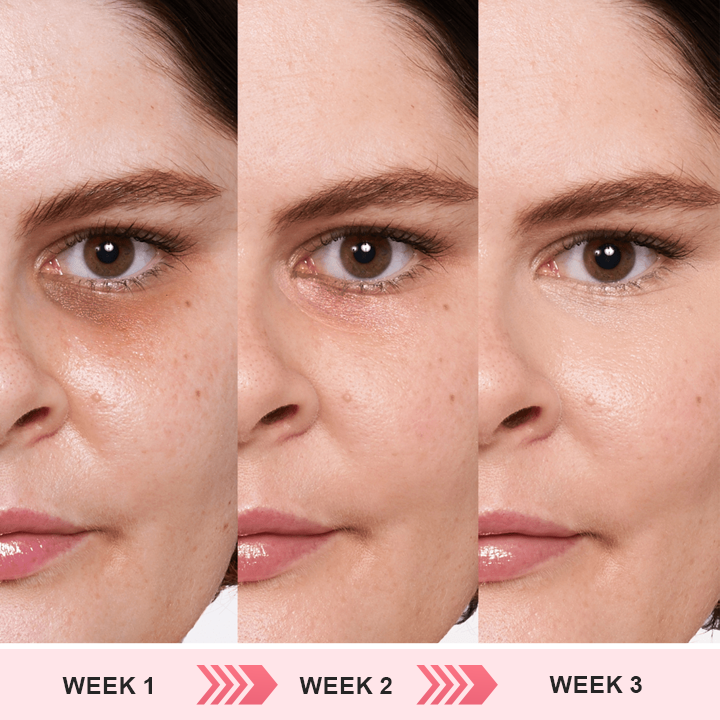 LIMETOW® Retinol Eye Stick