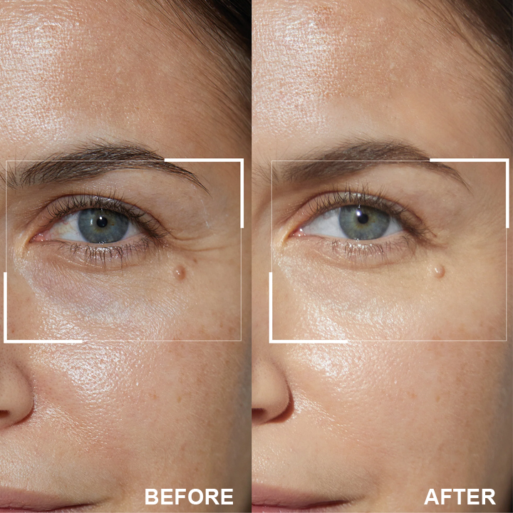 LIMETOW® Retinol Eye Stick