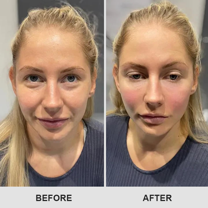 LIMETOW® Retinol Eye Stick