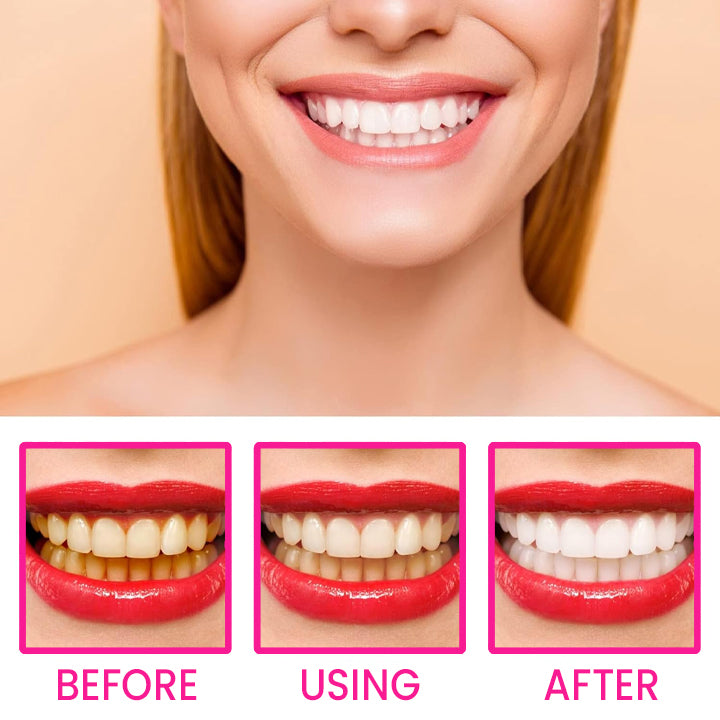 LIMETOW™ Teeth Whitening Pen