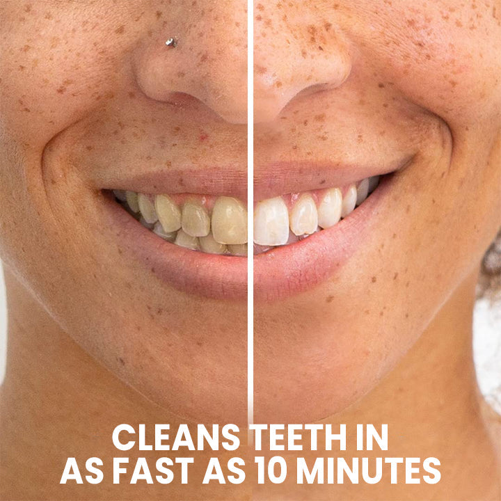 LIMETOW™ Teeth Whitening Pen