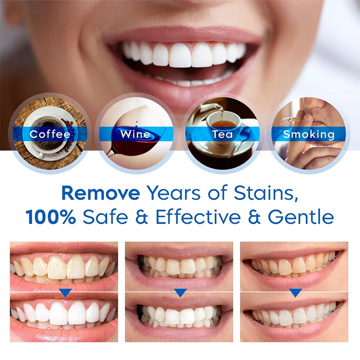 LIMETOW® Teeth Whitening Essence