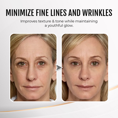 LIMETOW® Instant Eye Cream Tightener✨