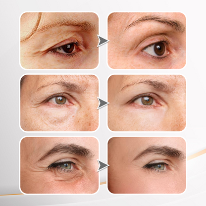 LIMETOW® Instant Eye Cream Tightener✨