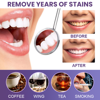 Last Day Discount ⏳LIMETOW™ Instant Teeth Whitening Paint: Smile Confidently🌟