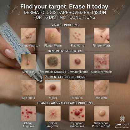Limited-Time Offer⚡LIMETOW® ⚡Skin Tag & Spot Eraser | Remove skin tags / age spots / dark pigmentation / stubborn skin concerns / raised skin growths / small neck bumps…