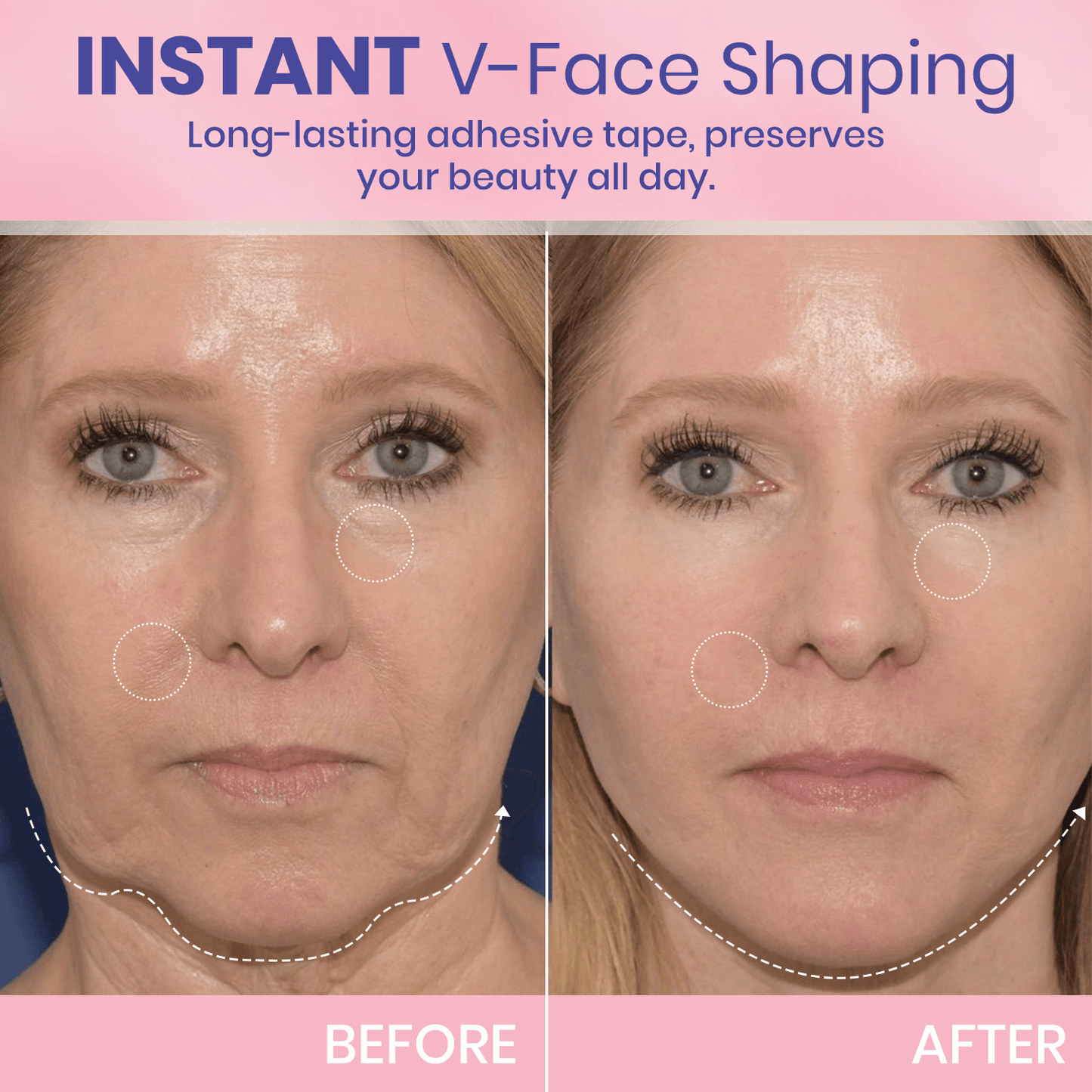 ✨ Invisible Face Lift Tape 💖 Instantly Sculpt Your Jawline & Hide Double Chin