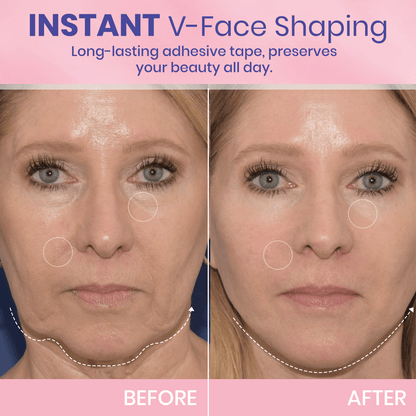 ✨ Invisible Face Lift Tape 💖 Instantly Sculpt Your Jawline & Hide Double Chin