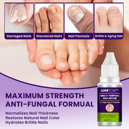 LIMETOW™🔥 Multi-Purpose Nail Repair 🔥