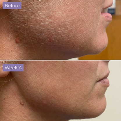 Cyperus Rotundus Skin Serum