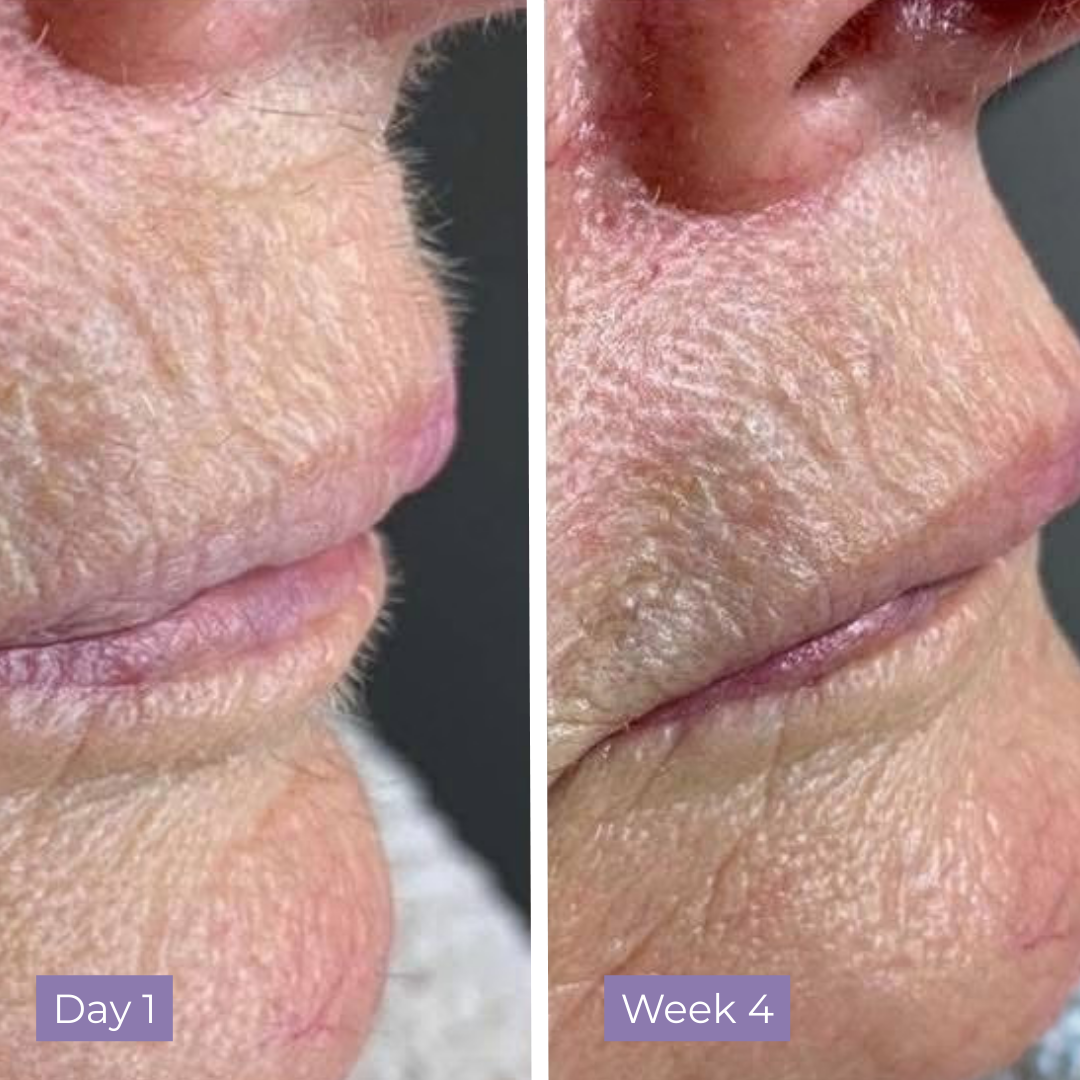 Cyperus Rotundus Skin Serum