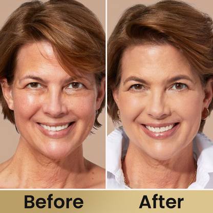 LIMETOW® Retinol Gold Eye Stick