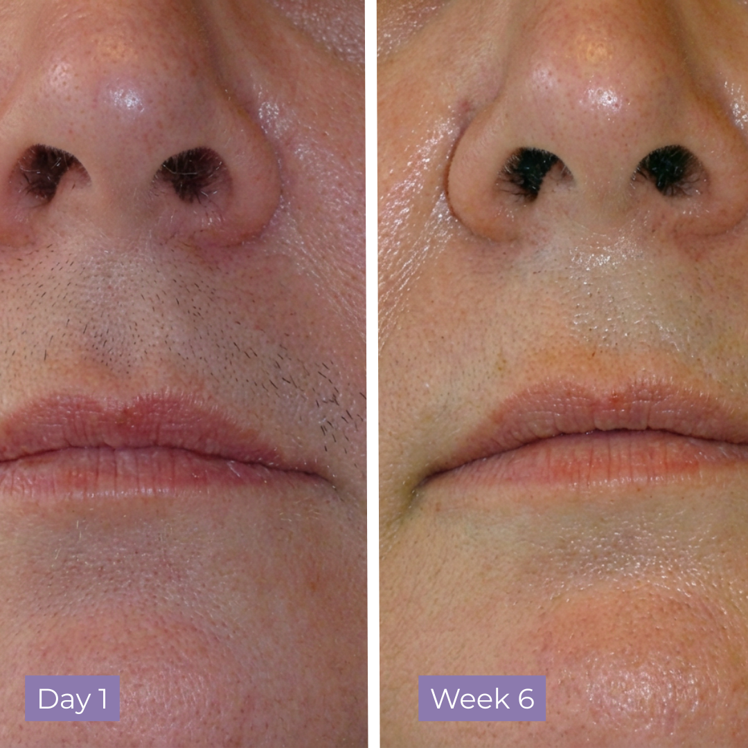 Cyperus Rotundus Skin Serum