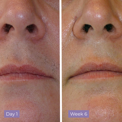Cyperus Rotundus Skin Serum
