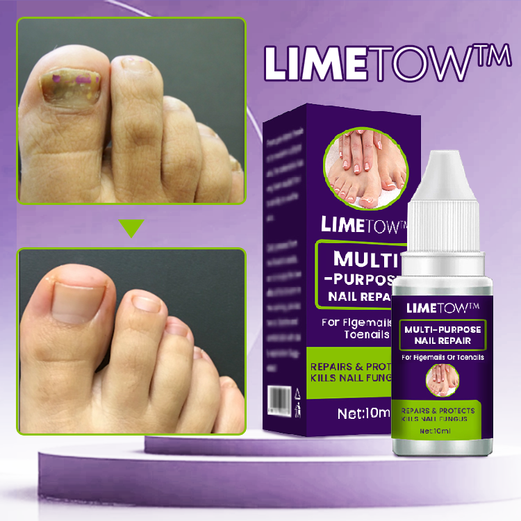 LIMETOW™🔥 Multi-Purpose Nail Repair 🔥