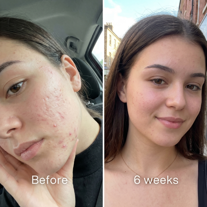Clinical Acne Scar Repair Stick