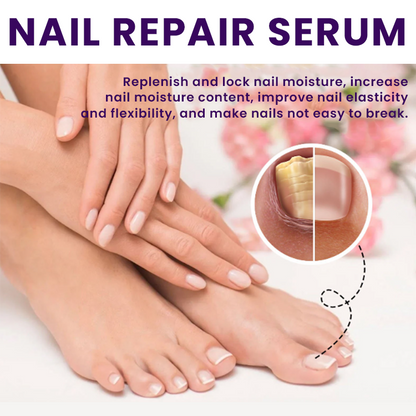 LIMETOW™🔥 Multi-Purpose Nail Repair 🔥