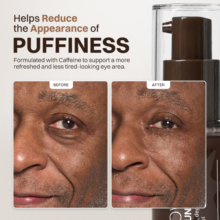 LIMETOW® Enhanse Under Eye Gel
