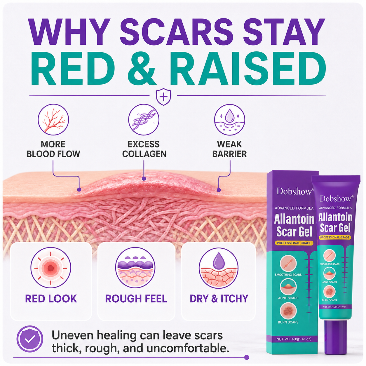 Allantoin Scar Gel