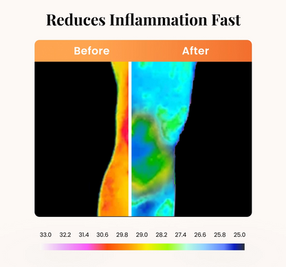 ⚡Limited-Time Offer-Natural Relief Balm That Actually Works