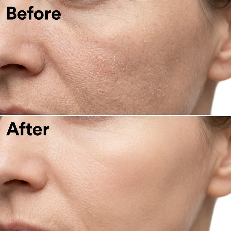 Korean Rice Face Peel