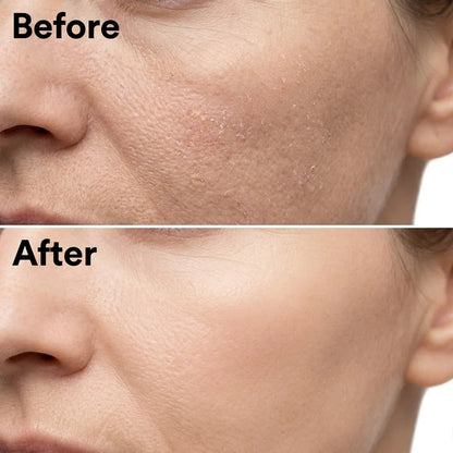 Korean Rice Face Peel