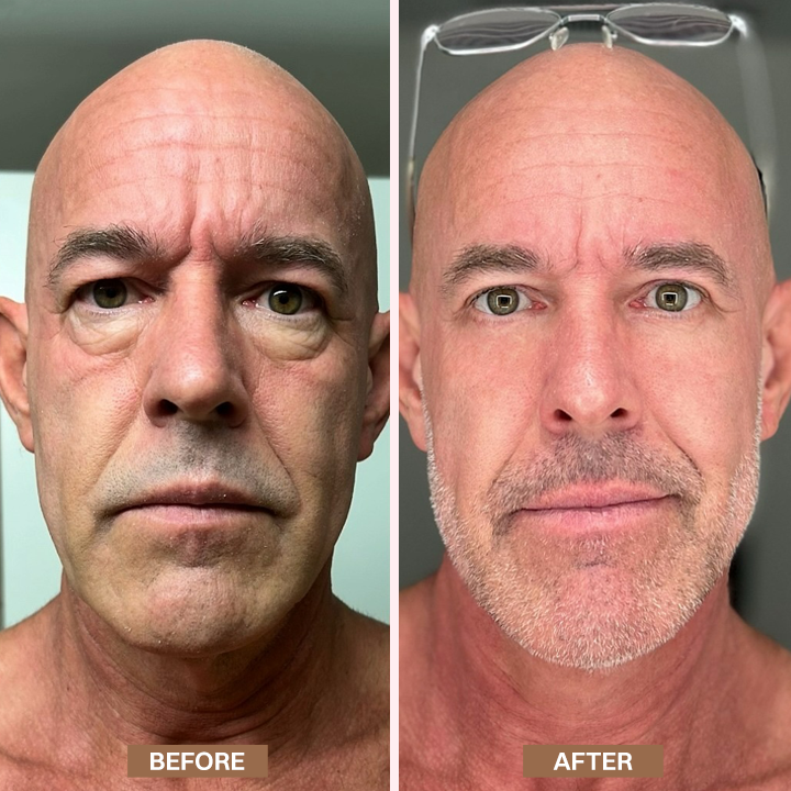 LIMETOW® Enhanse Under Eye Gel