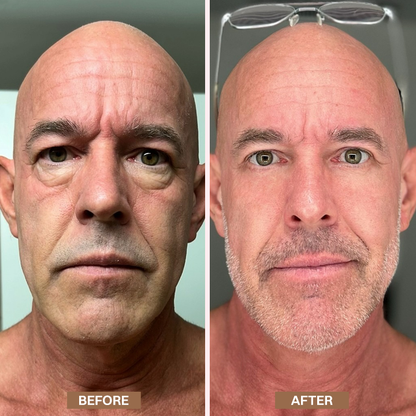 LIMETOW® Enhanse Under Eye Gel