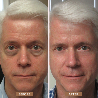 LIMETOW® Enhanse Under Eye Gel