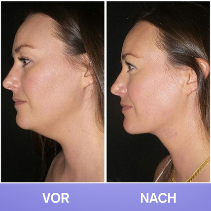 LIMETOW® Tighten & Lift Neck Cream 🔥New Product Discounts🔥 Last Day✨