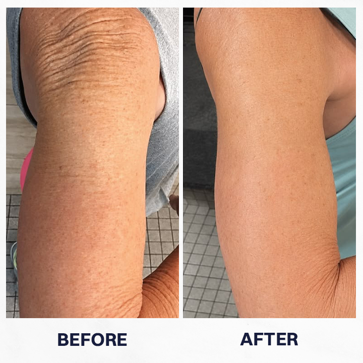 LIMETOW® WHITE TOMATO RENEWAL CREAM