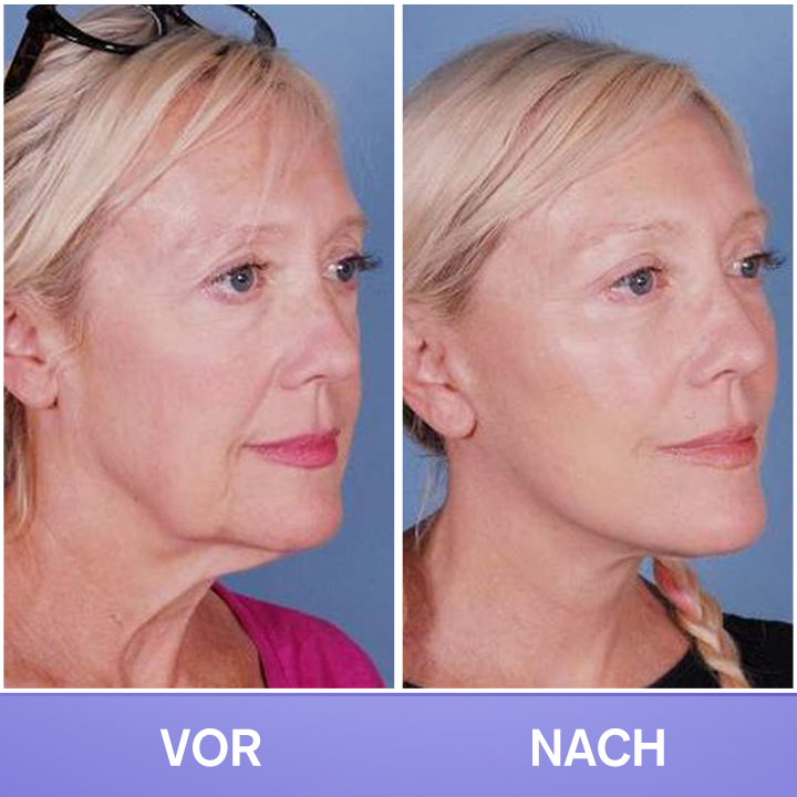 LIMETOW® Tighten & Lift Neck Cream 🔥New Product Discounts🔥 Last Day✨