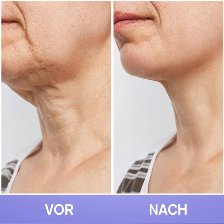 LIMETOW® Tighten & Lift Neck Cream 🔥New Product Discounts🔥 Last Day✨