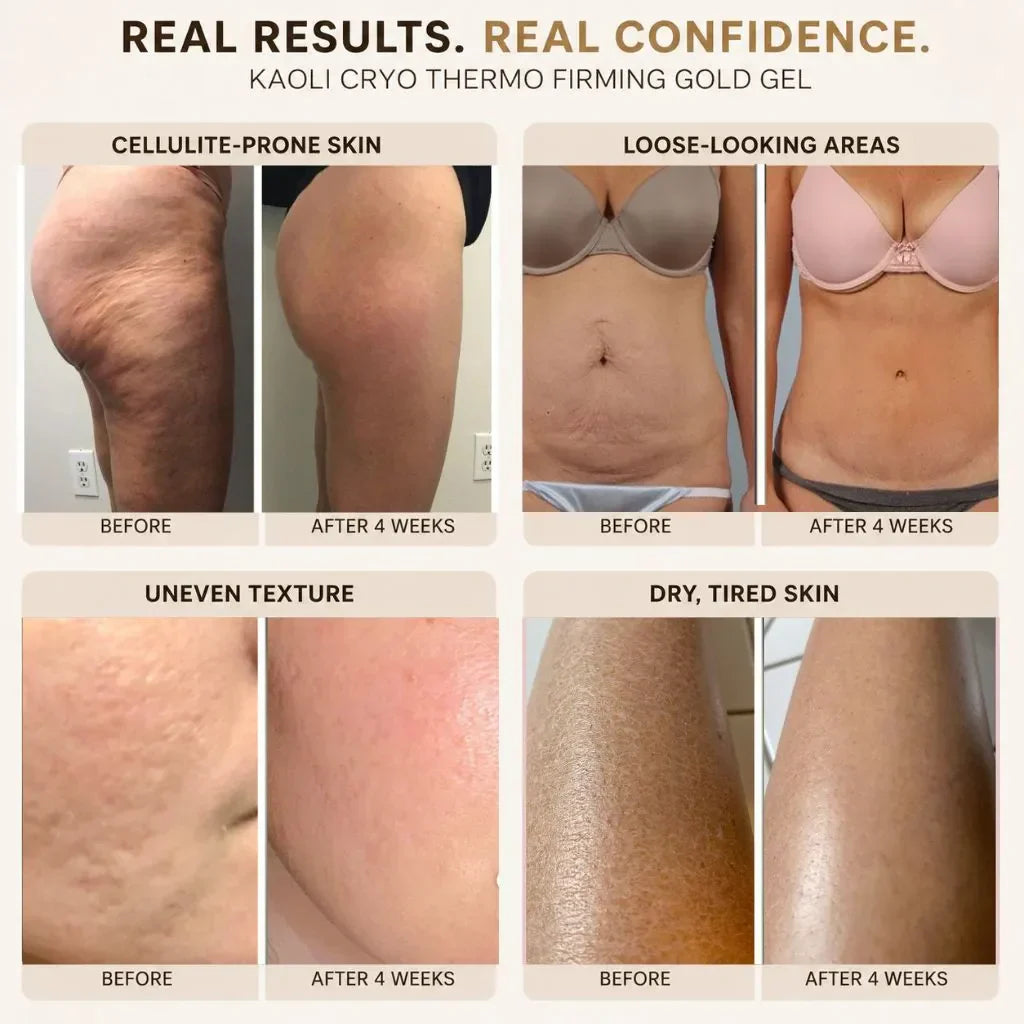 Limited-Time Offer⚡ Gold Sculpt Firming Gel