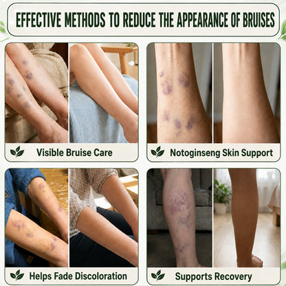 LIMETOW® Skin Strengthening Cream– Natural Relief for Bumps, Impacts & Everyday Scrapes