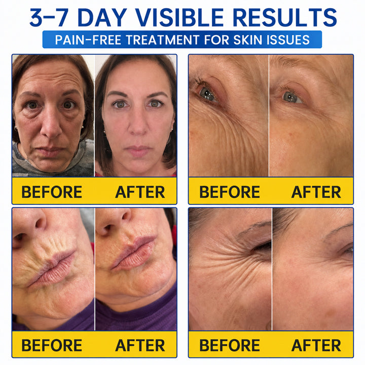 PDRN WRINKLE LIFT TIGHTENING CREAM 🌊