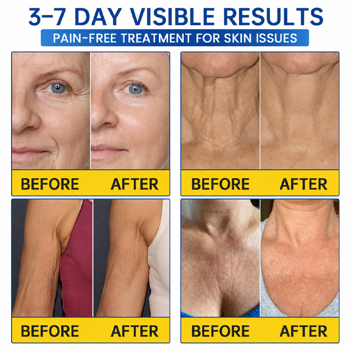 PDRN WRINKLE LIFT TIGHTENING CREAM 🌊