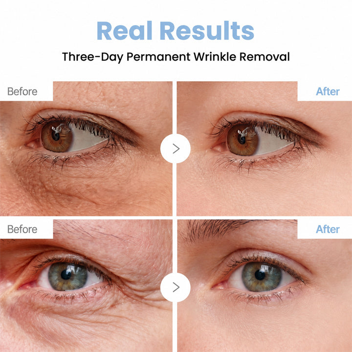 PDRN WRINKLE LIFT TIGHTENING CREAM 🌊